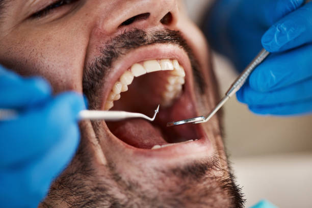 Best Emergency Treatment for Toothache in Rockwell, NC