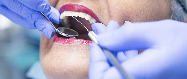 Best Emergency Tooth Extraction in Rockwell, NC